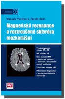 Magnetická rezonance a roztroušená skleróza mozkomíšní