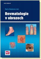 Revmatologie v obrazech