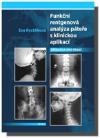 Funkční rentgenová analýza páteře s klinickou aplikací